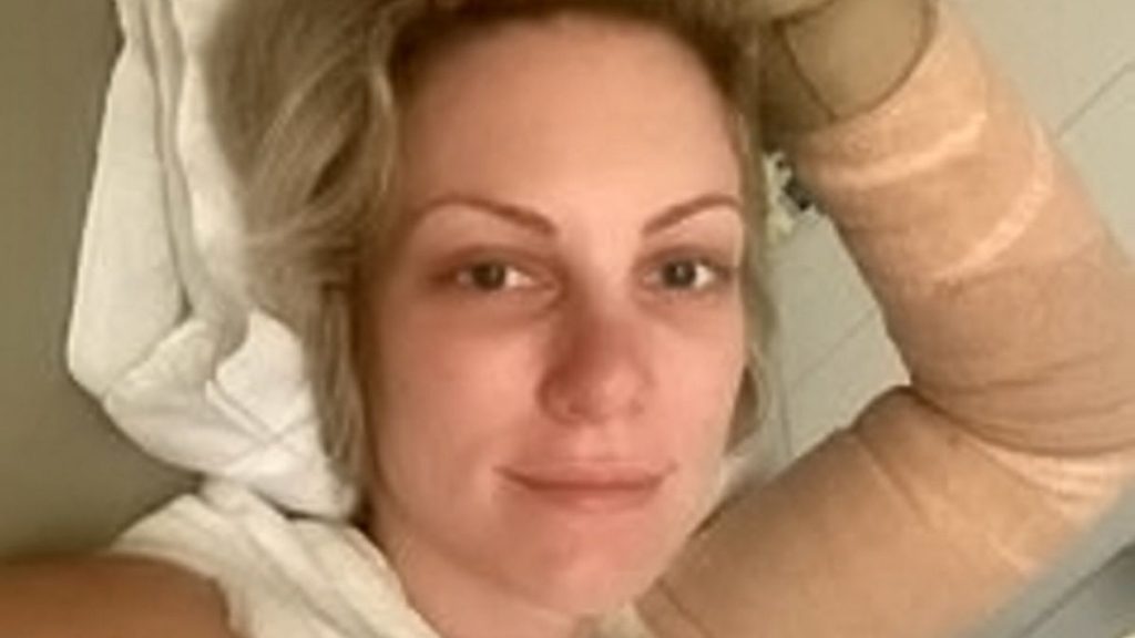 29-årige Abbie besvimer under madlavningen: Da hun vågner, er hendes bryster ‘smeltet’