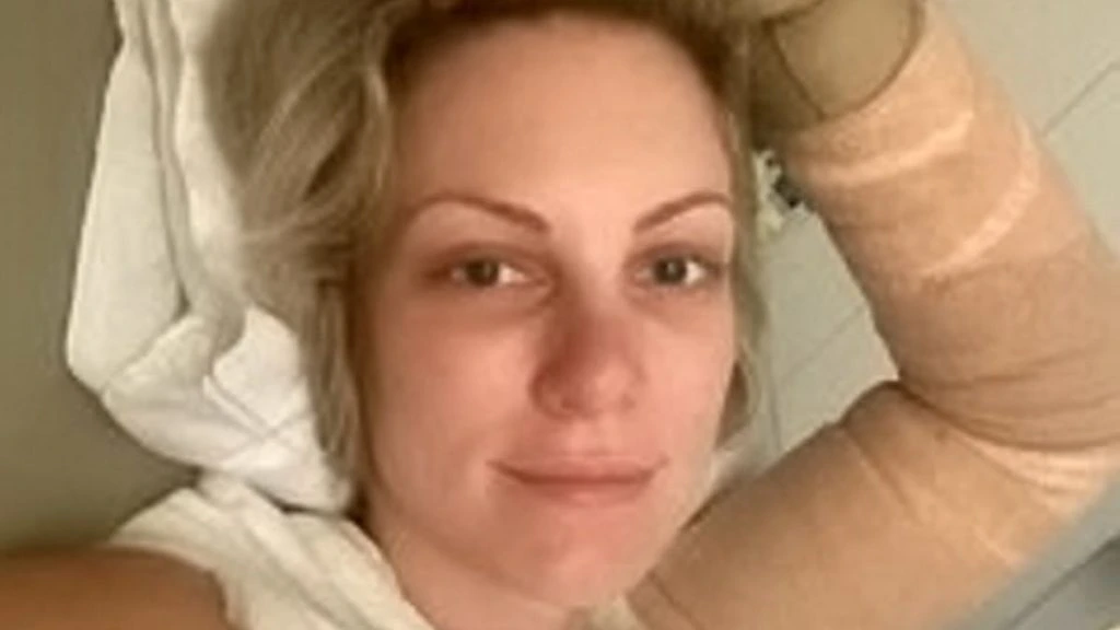 29-årige Abbie besvimer under madlavningen: Da hun vågner, er hendes bryster ‘smeltet’