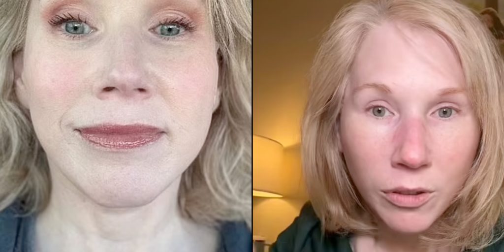 53-årig kvinde chokerer med udseende efter ansigtsløft: Det ligner to forskellige personer