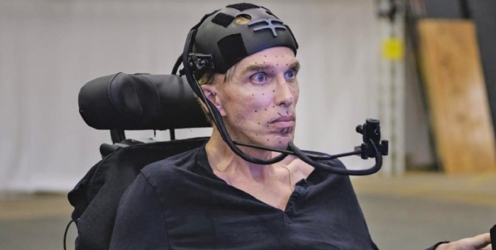 ‘Verdens første cyborg’ er død