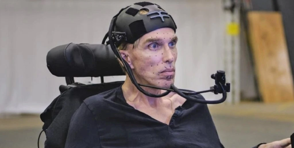 ‘Verdens første cyborg’ er død