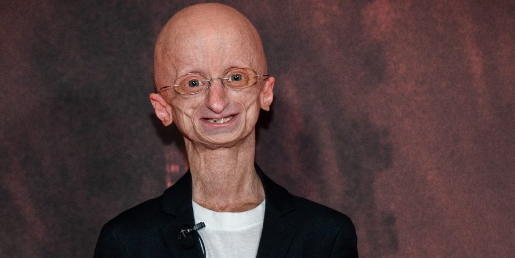 Jesper Sørensen overrasket: Fik bind for øjnene og blev kørt væk