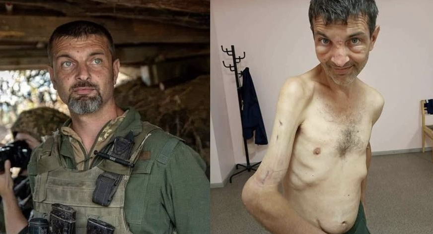 Blev holdt i russisk fangenskab: Billederne, der viser de voldsomme konsekvenser, deles verden over