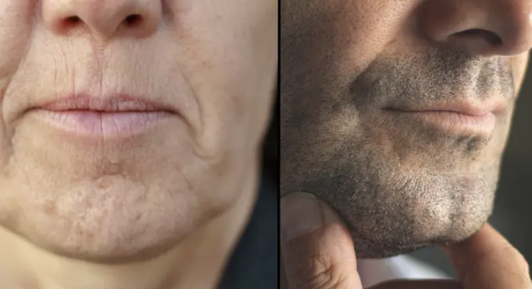 Ekspert afslører årsagen bag ‘hagehuller’ – men det får folk til at rase