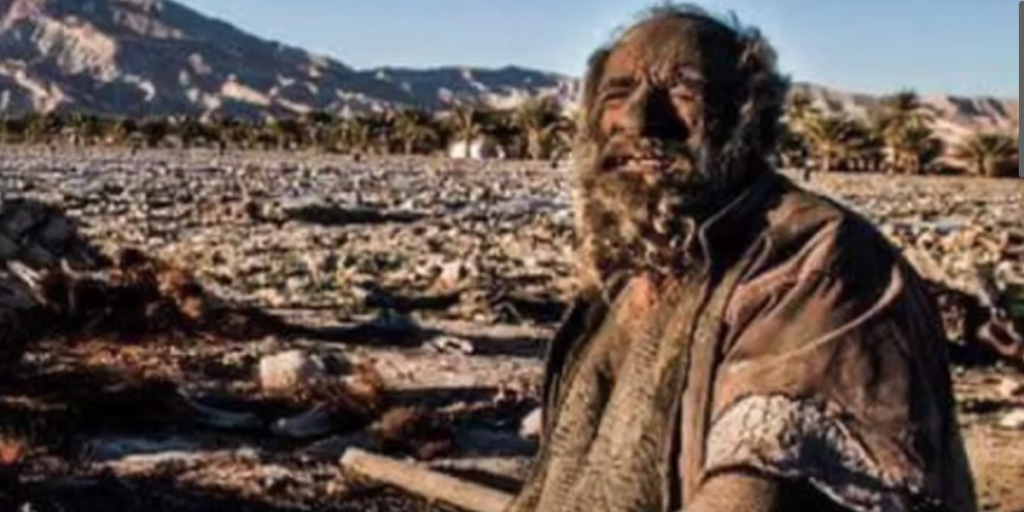 ‘Verdens mest beskidte mand’ fik sit første bad i 60 år: Døde kort tid efter