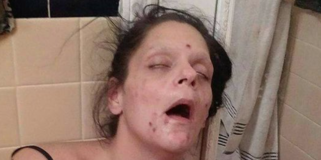 Melissa var stærkt afhængig af heroin: 7 år senere er hun ikke til at kende