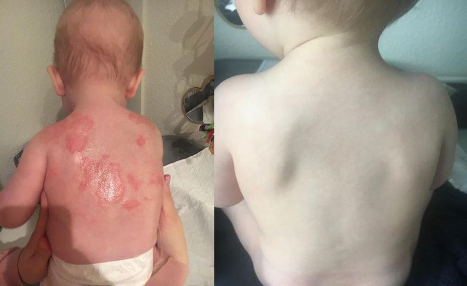 Alt for mange børn rammes: Stor stigning på blot ti år