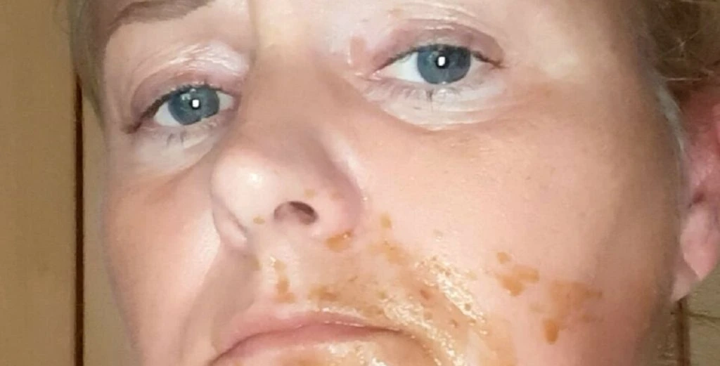Amanda tog en lur: Pludselig havde hendes hund lagt noget ulækkert i hendes mund