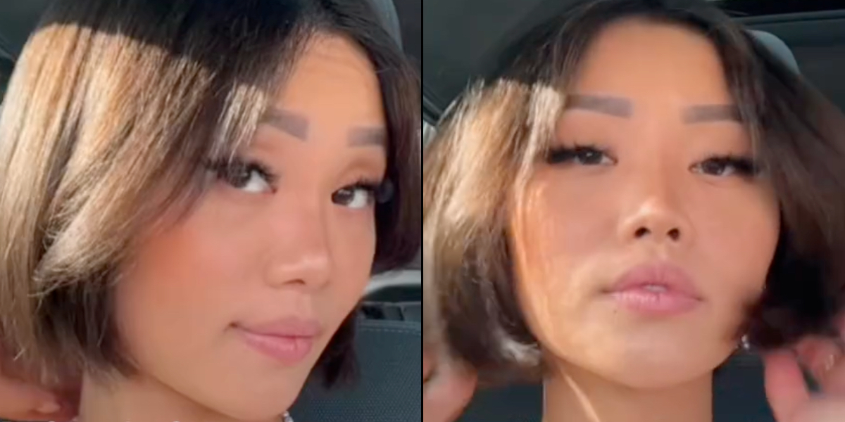 Kvinde føler sig ‘uretfærdigt behandlet’: Afslører vild forvandling af ansigt under graviditet