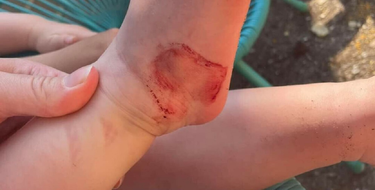 29-årig mor advarer efter dette: – Det skræmte mig