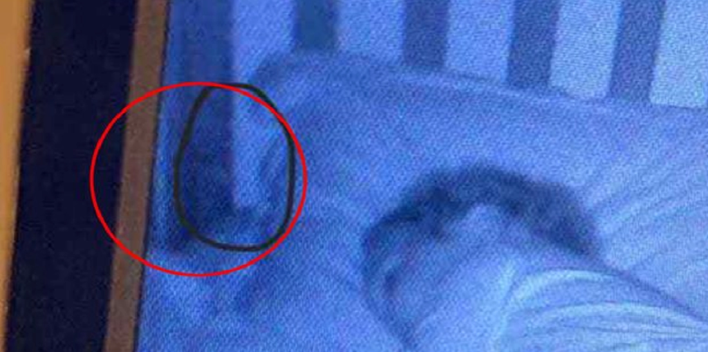 Mor lagde sin datter til at sove: Hvad hun derefter så på babyalarmen, efterlod hende i rædsel