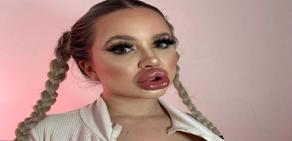 ‘Levende Barbie-dukke’ har brugt 450.000 på plastikoperationer: Giver sine forældre skylden
