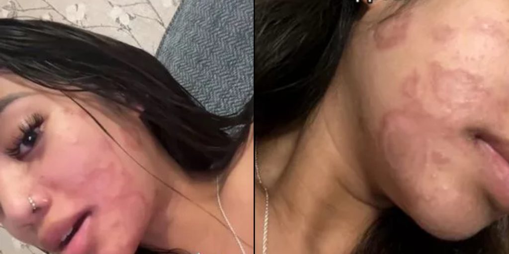 Ung kvinde rengjorde ikke sine makeup-børster efter brug: Det endte hun med at fortryde