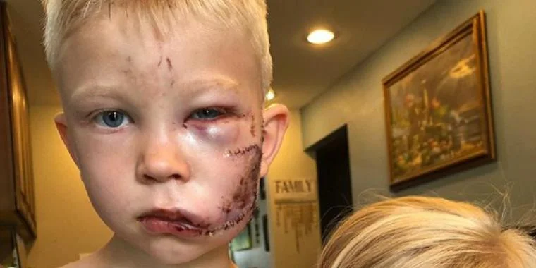 6-årig redder søster fra bidsk hund – Nu får han en helt særlig belønning