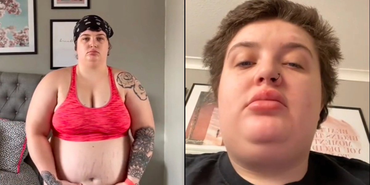 26-årig kvinde har smidt over 41 kg: I dag ligner hun en helt anden kvinde