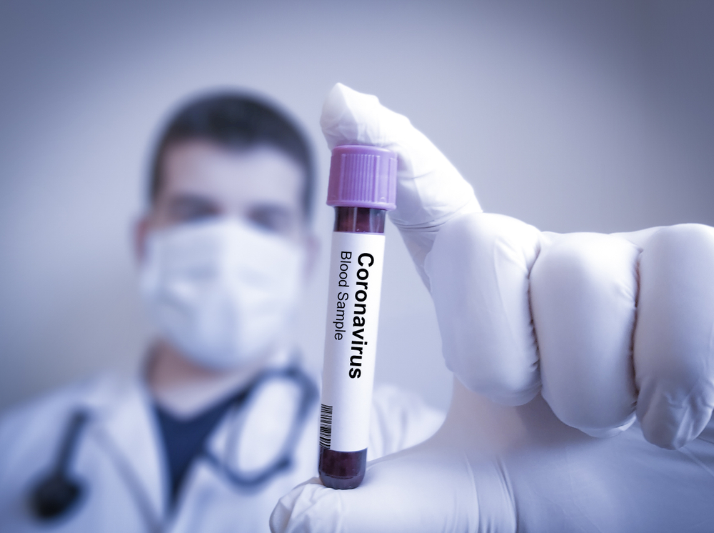 Kinesisk forskning: Coronavirus transmitteres dårligere ved højere temperaturer