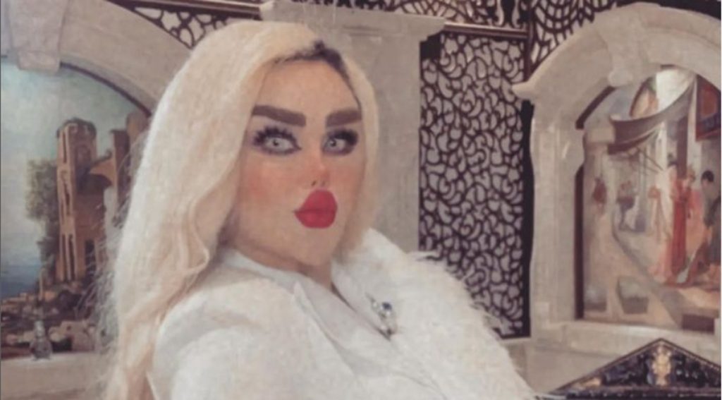 Kvinde er blevet opereret 43 gange for at ligne Barbie: Nu bliver hun kaldt for “Zombie”