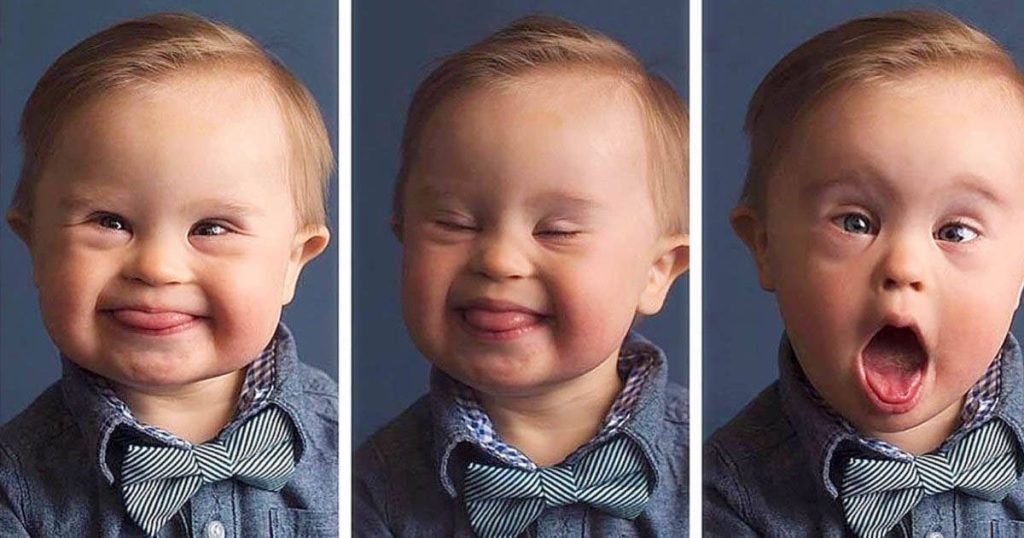 Blev afvist af modelbureau, fordi han har Downs syndrom: Nu tager han verden med storm