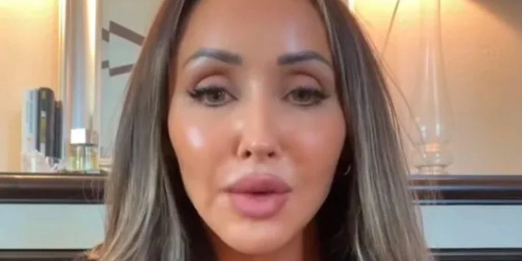 Kvinde har brugt over 180.000 kroner på Botox og filler: Nu viser hun, hvordan hun ser ud uden