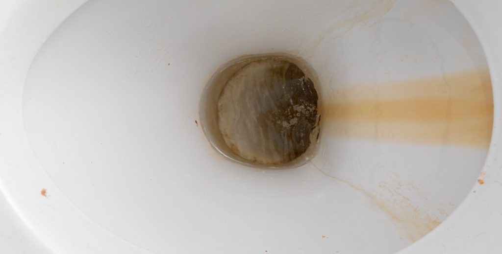 Her er metoden, hoteller bruger til at fjerne brune pletter fra toilettet