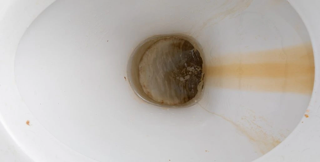 Her er metoden, hoteller bruger til at fjerne brune pletter fra toilettet