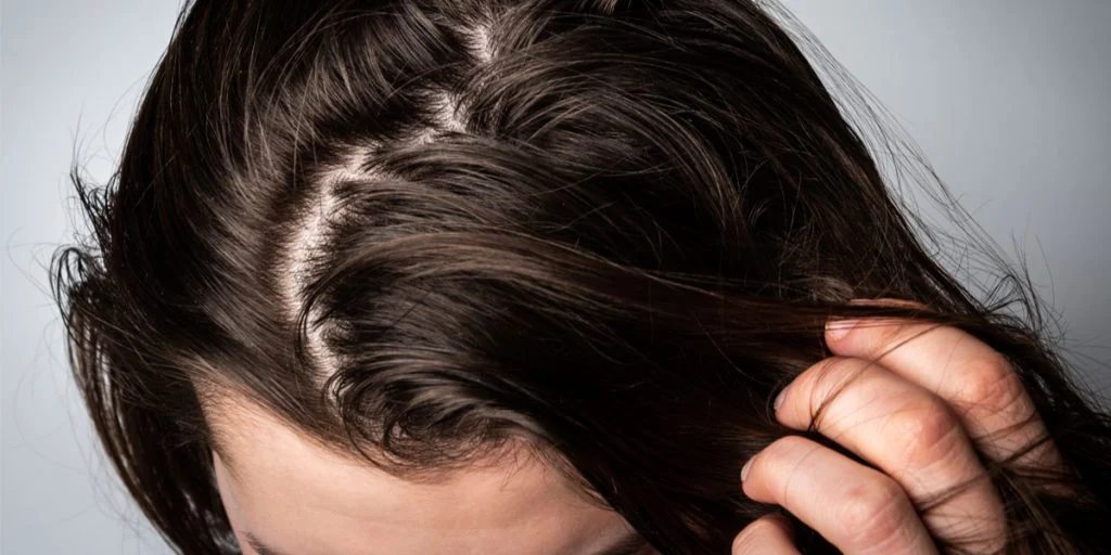 Sådan slipper du nemt og billigt af med fedtet hår