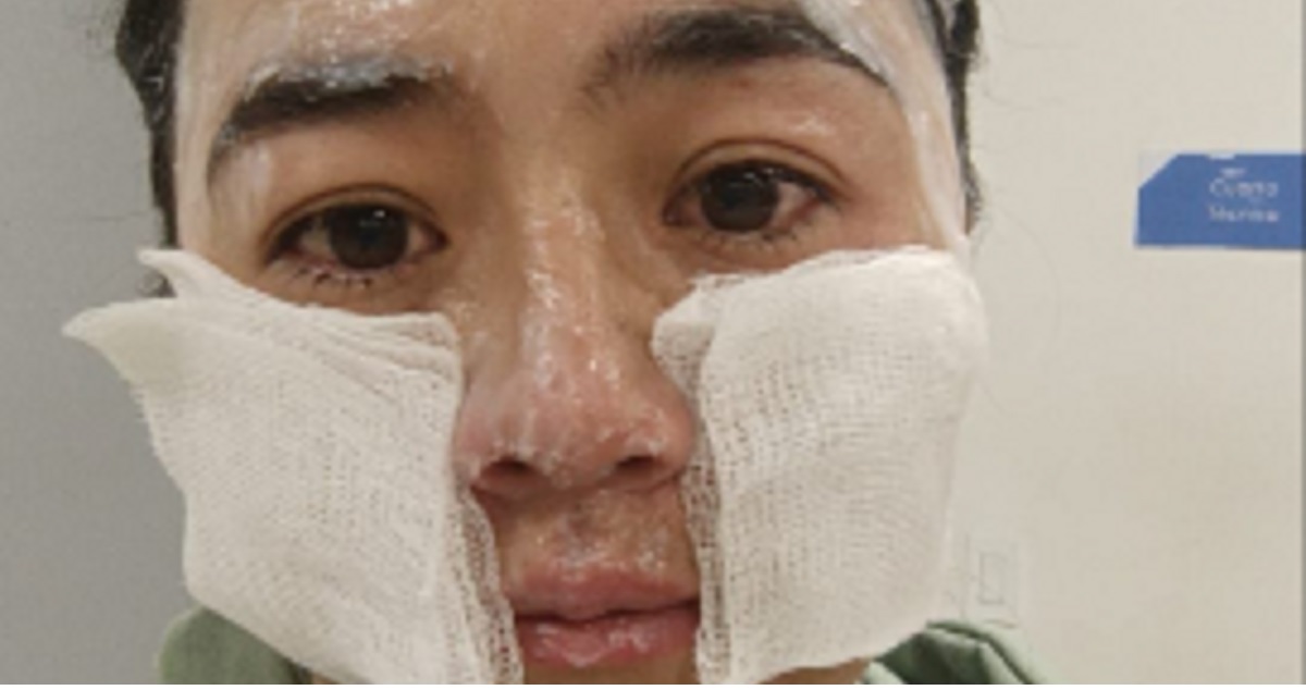 Kvinde indlagt efter voldsom hjemmeulykke: Nu advarer hun andre