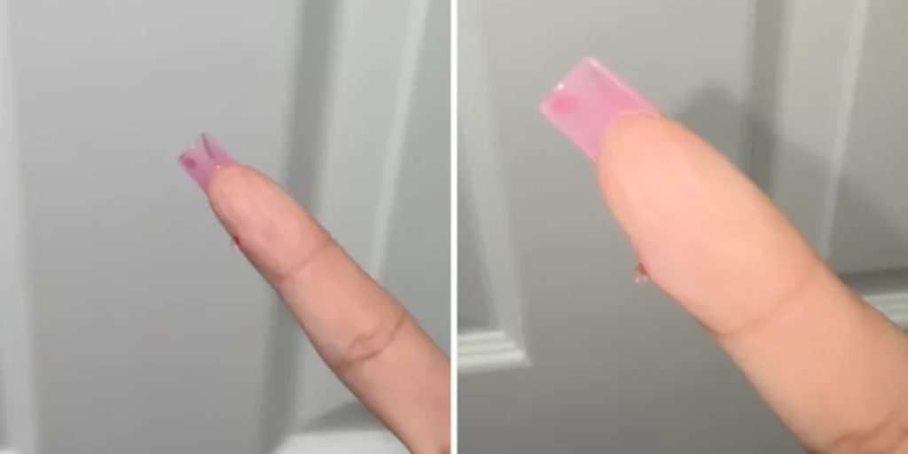 Servitrice skar sig på glas: Først 3 år senere opdagede hun den vilde sandhed