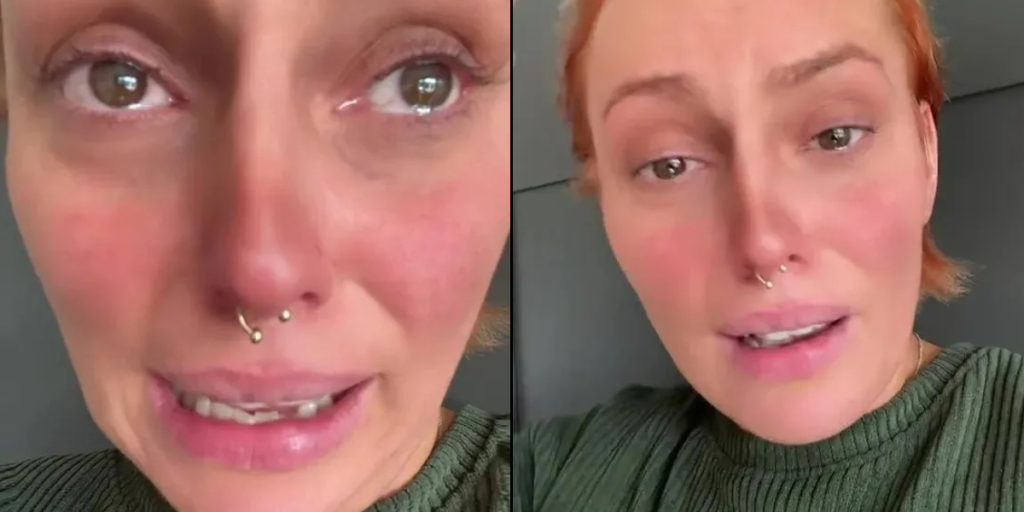 Hun valgte at farve hår selv for at spare penge: Fortrød det lige så snart hun så resultatet