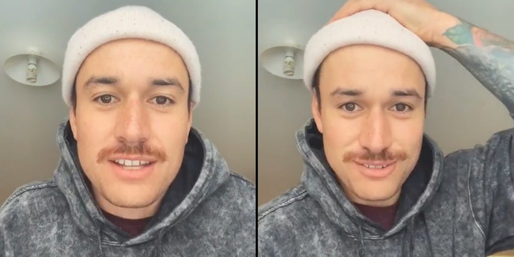 Ung mand har altid hat på: Da han endelig tager den af, afslører han hvorfor