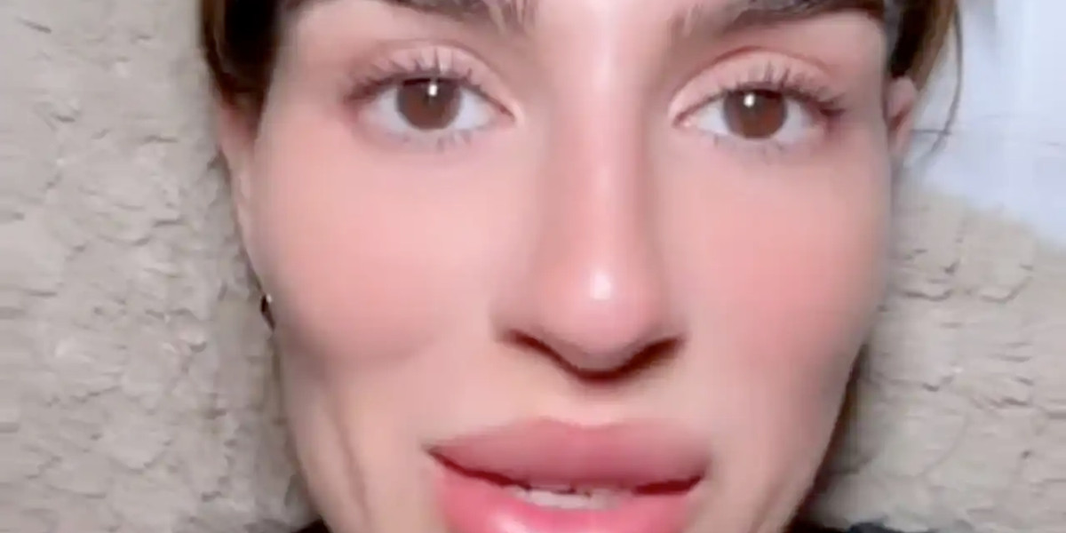 Hun er 41 år og har pænere hud end i sine 20’ere: Nu afslører hun sin særlige hemmelighed