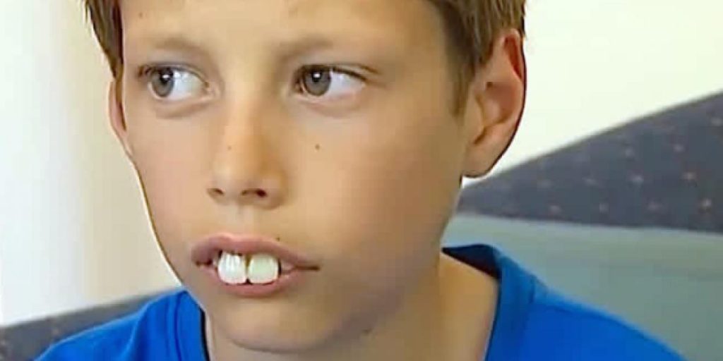 Han blev mobbet og kaldt kanindreng: I dag er han ikke til at kende