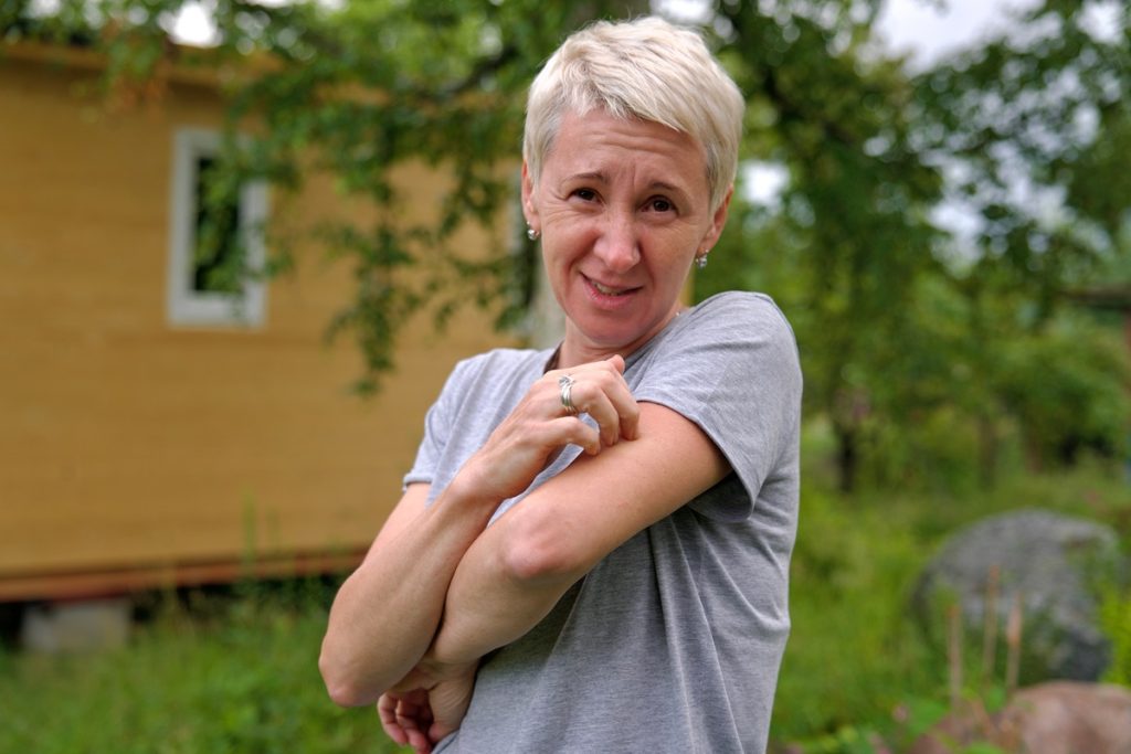 Forskerne har selv kløet sig i håret, men nu har de svaret: Derfor klør din krop