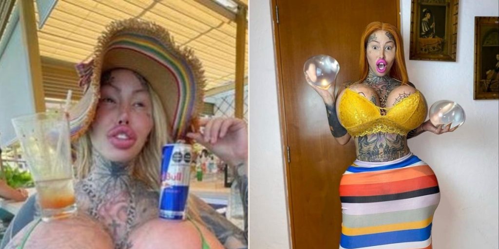 Har brugt 675.000 kroner på kosmetiske indgreb: Nu viser hun, hvordan hun så ud før