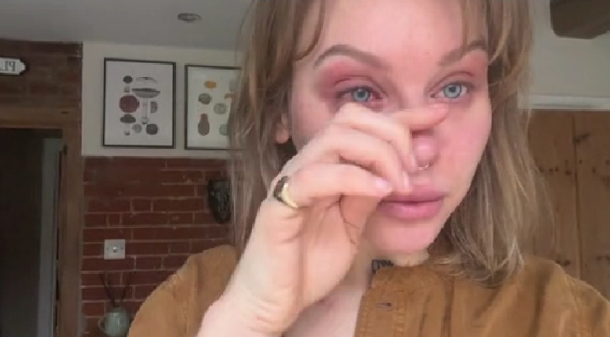 Danielle fik lavet større bryster som 19-årig: Endte med at miste synet