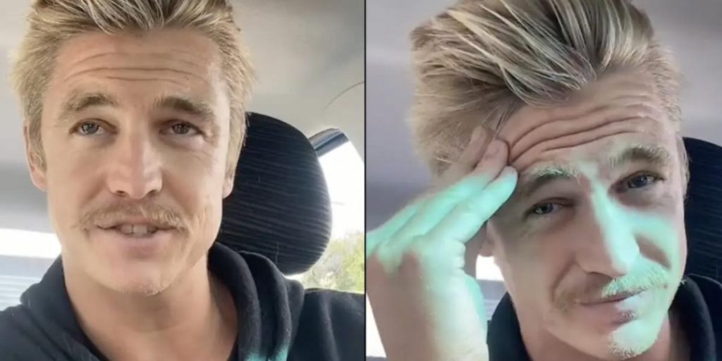 Nick har ikke vasket hår i 6 år: Sådan ser det ud