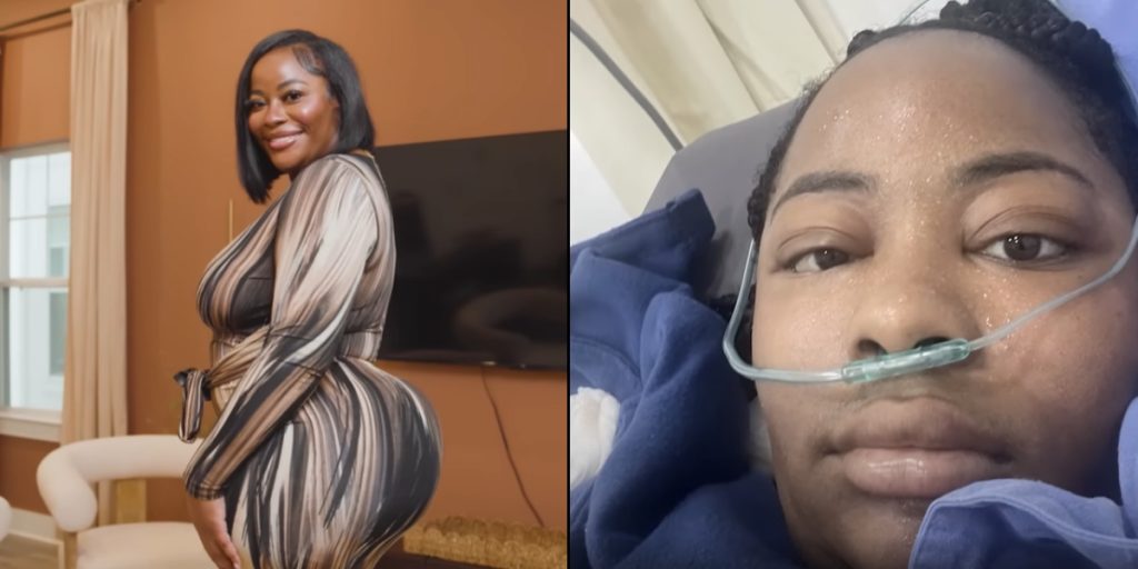 Influencer rejste til Mexico for billig numseoperation: Det var tæt på at koste hende livet