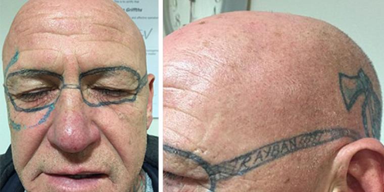 Solid druktur: Vågner op med Ray Ban-solbriller tatoveret i ansigtet