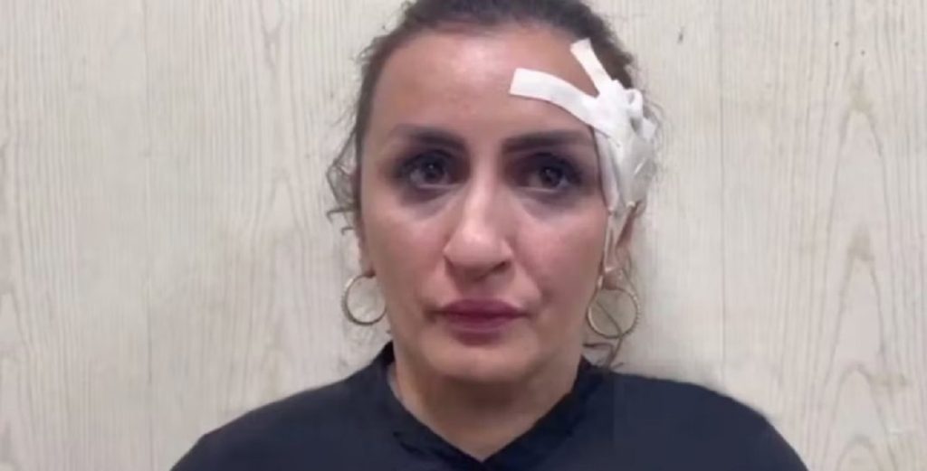 Mor solgte sin baby: Ville have en ny næse