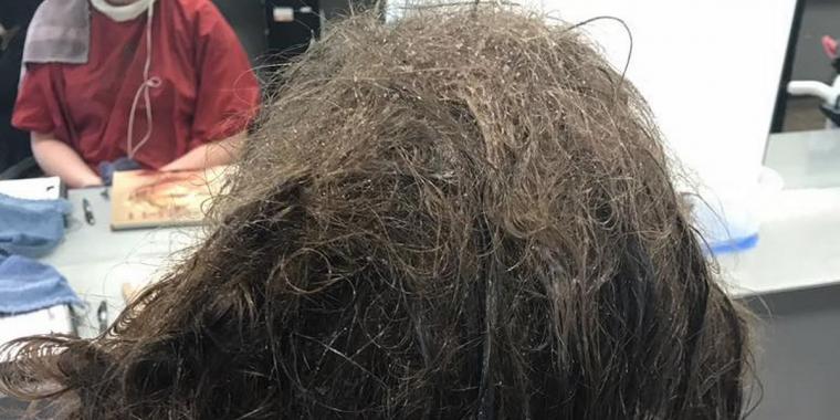 Frisør nægter at barbere deprimeret teenagepiges sammenfiltrede hår til skolebilleder