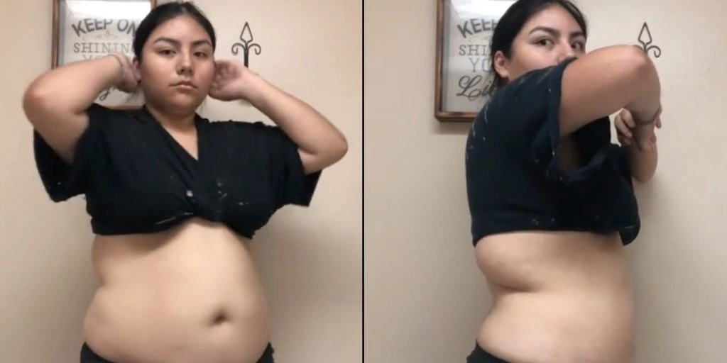 22-årige Sara har tabt sig over 50 kg: Hun tilskriver det disse 2 simple ting