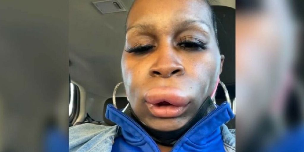 Mor fik et chok, da han så sig selv i spejlet: – Jeg ligner en kamel