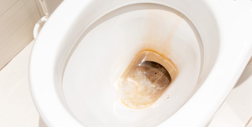 Her er tricket, ejendomsmæglere bruger til at fjerne brune pletter fra toilettet