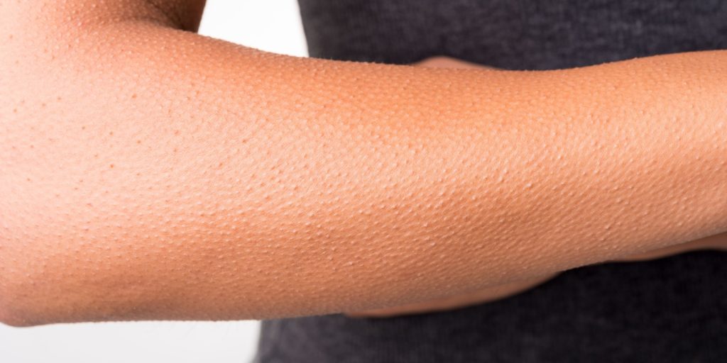 6 fascinerende ting om din krop: Derfor har du ørevoks, gåsehud og hikke