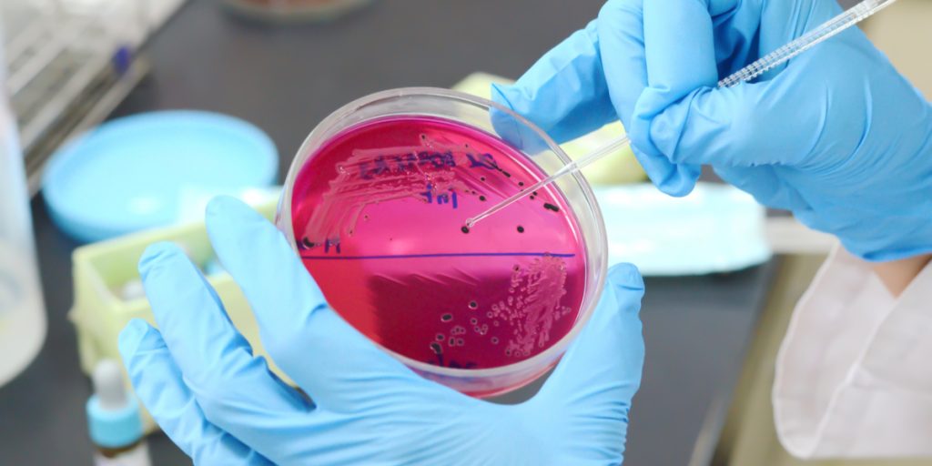 Stort salmonella udbrud: Har spredt sig i hele landet