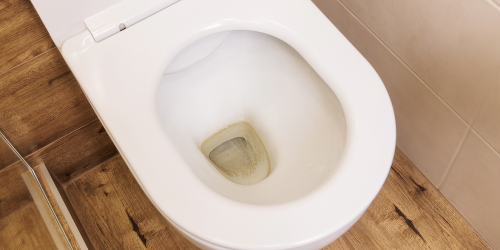 Slip af med grimme pletter i toilettet