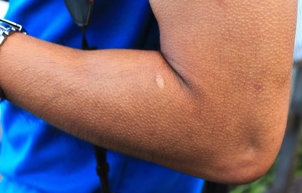 Alle mennesker oplever denne reaktion: Det har den af betydning