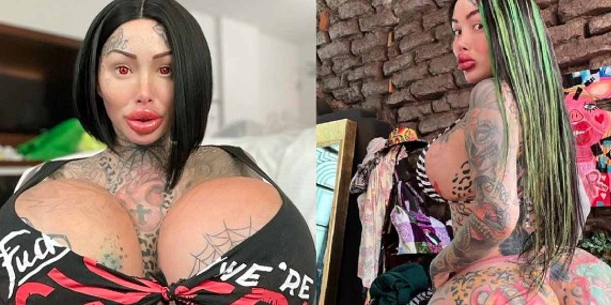 Mary var afhængig af plastikkirurgi: Nu advarer hun andre