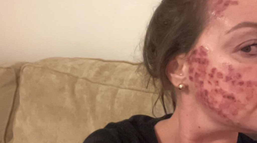 Mange gør det: Nu advarer 35-årig mod denne vane