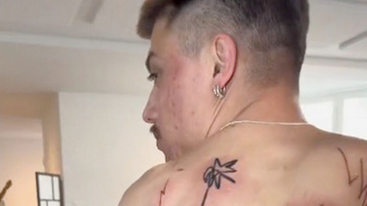 Mand betalte 7.000 kroner for rygtatovering: Folk mener, at den ligner en børnetegning